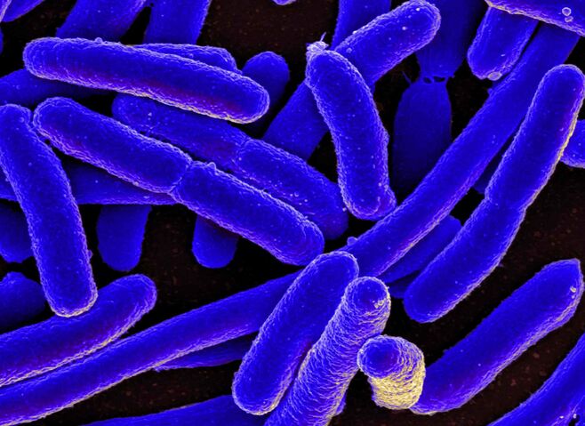 E. coli a miúdo provoca o desenvolvemento de cistite nas mulleres